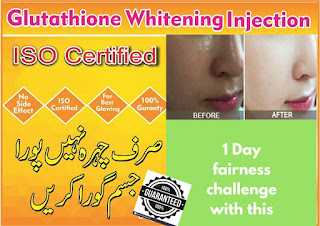 product-tag/anti-pigmentaion-products-in-pakistan/