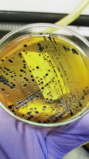 Ágar Salmonella Shigella com crescimento de Salmonella spp.