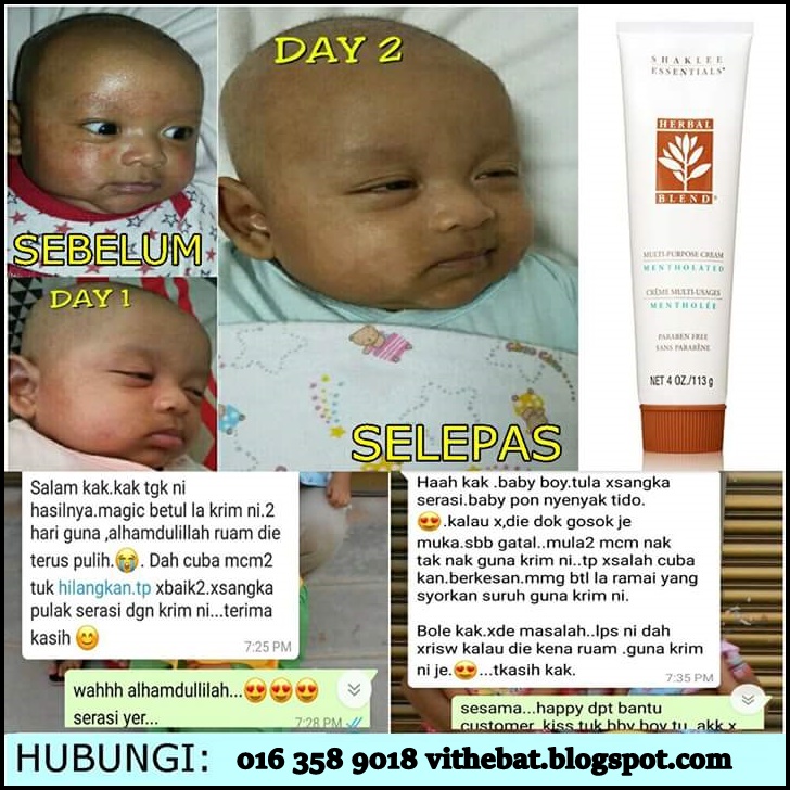 Badan Sihat Hati Ceria Cara  Hilangkan Ruam di  Muka  dan 