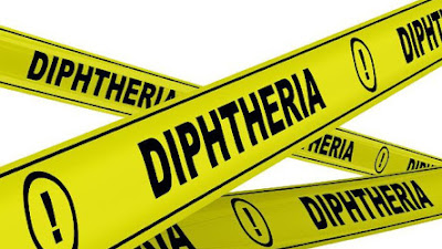Pesisir Selatan Pastikan Aman Dari Kasus Difteri 