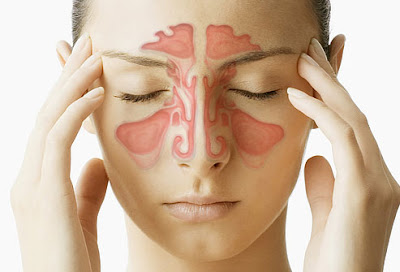 Sinusitis, Pengobatan Sinusitis