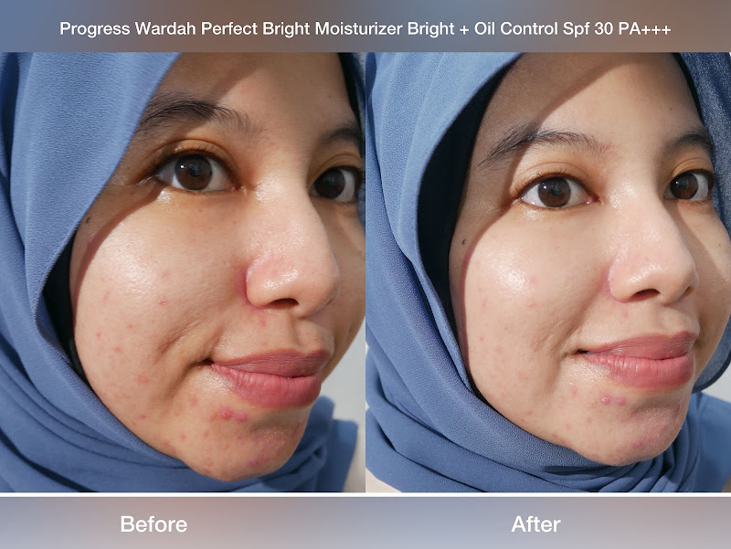 Progress Wardah Perfect Bright Moisturizer Bright + Oil Control SPF 30 PA+++