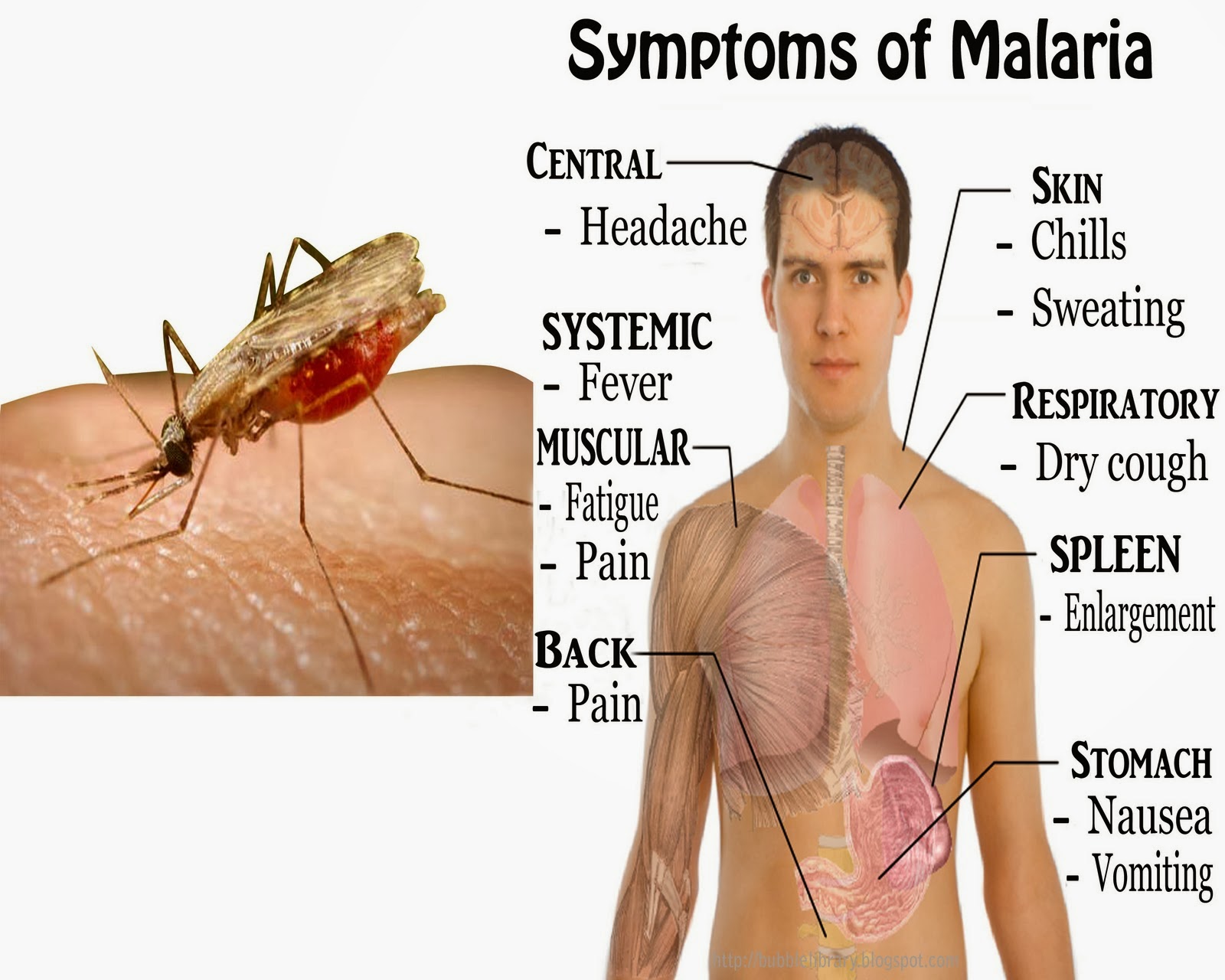 Penyakit Malaria Dan Cara Mengobatinya Kriteriator Hubblaa