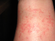 . so nothing has bitten me. And I've had it for just over a week now.