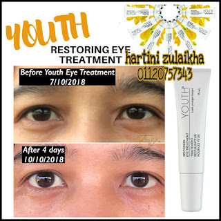 masalah eye bag, eye bag pada mata, masalah mata lebam, mata letih , cara atasi mata penat, cara atasi mata lebam , eye treatment yang berkesan, eye treatment mampu milik , eye treatment halal, pengedar shaklee perlis , pengedar shaklee kangar, cod vitamin shaklee, cod vitamin shaklee kangar.