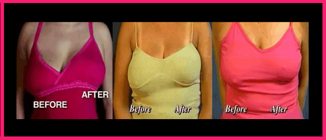 Here is How to Prevent Sagging Breasts Naturally