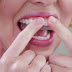 Hướng dẫn cách sử dụng miếng dán trắng răng