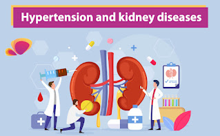 Hypertension and Kidney Diseases
