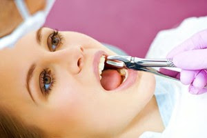 Nhổ răng thừa có nguy hiểm không? 