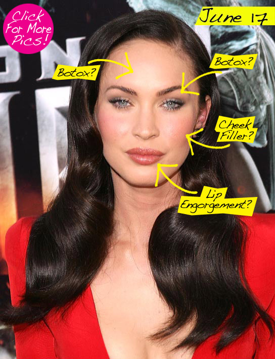 megan fox lip job. lip injections! Megan you