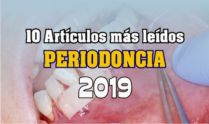 10 artículos de PERIODONCIA más leídos en el 2019