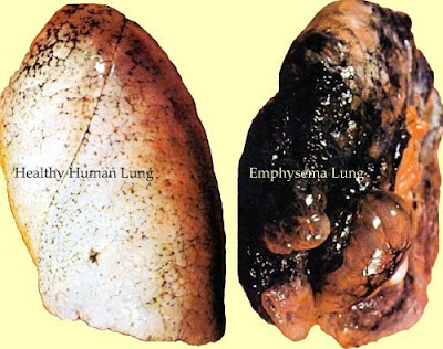 effect of smoking 