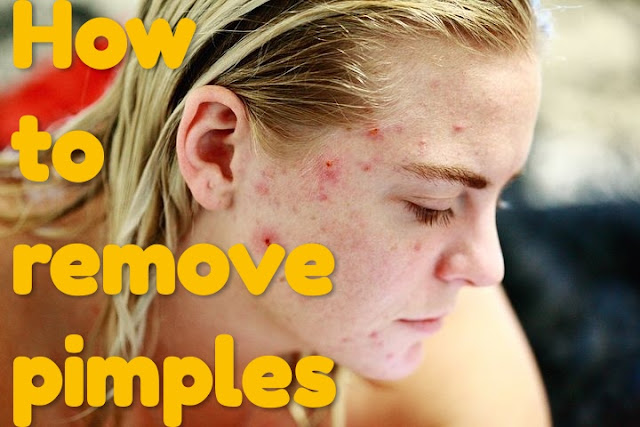  How to Remove Pimples | How to Get Rid of Pimples health tips