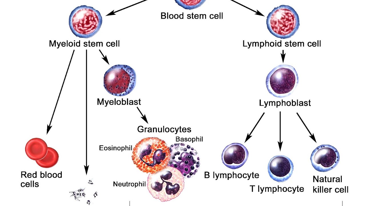 Acute Lymphoblastic Leukemia Type B Survival Rate