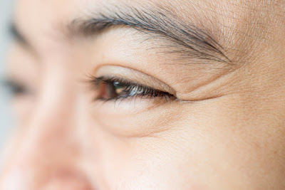 How Can I Get Rid Of Wrinkles?
