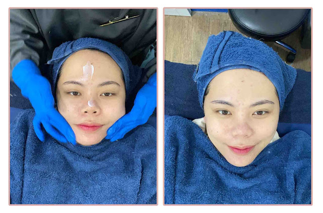Acne Care Treatment di TIUwoo Korean Beauty