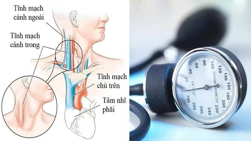 Vị trí tĩnh mạch cảnh và đo huyết áp