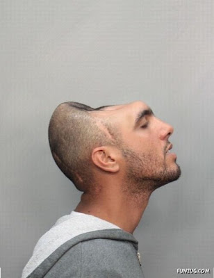 Man With Half Head