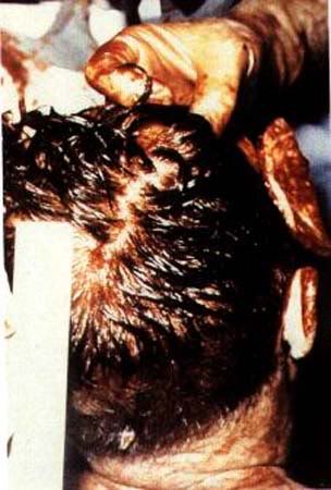 president kennedy autopsy. DVP#39;s JFK ARCHIVES: 1978