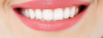 Răng bị lộ ngà bọc sứ có hiệu quả không? 2