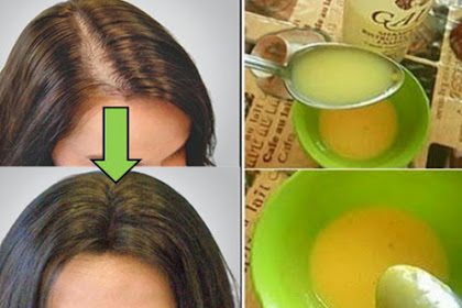 Leave All Doctors Surprised: Apply This Remedy and Your Hair Will Grow Faster Than Ever