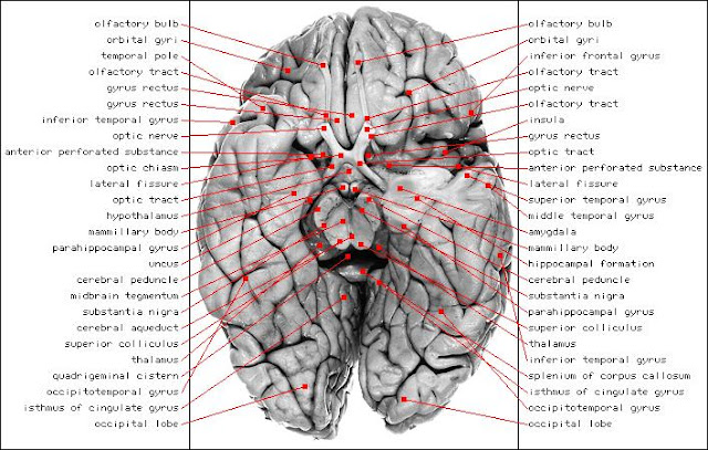 Brain Vasculature7