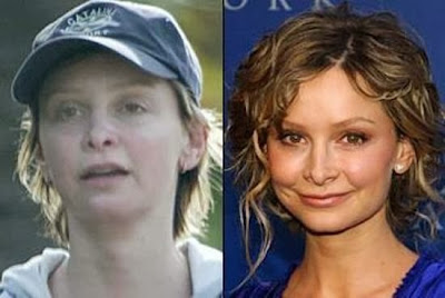 Calista Flockhart Plastic Surgery Nose Job and Lips Augmetation Before and After