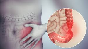 متلازمة القولون العصبي(IBS) ..الأسباب والأعراض وكيفية الوقاية منه و٥ طرق للعلاج