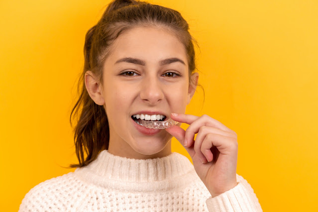 Reasons to Choose Clear Aligners