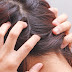 Home Remedies For Scalp Fungus Infection 