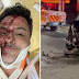 Irmão do Rodrigo Faro sofre acidente de carro 