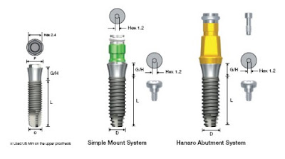 Trồng răng implant có được lâu dài không ?