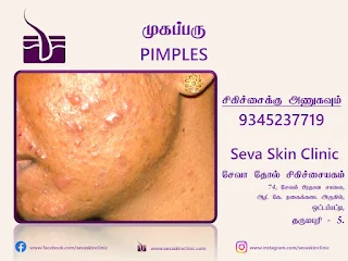 pimples treatment