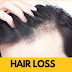 Reasons for hair loss. జుట్టు రాలడానికి శాస్త్రీయ కారణం ఏమిటి? 