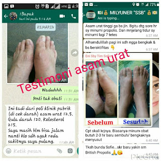 Obat Asam Urat Alami British Propolis Ampuuh dan Paten