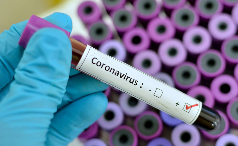 Everything You Should Know About Coronavirus