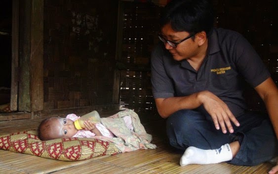 Dinkes Banten Bantu Devi, Bayi Kurang Gizi Asal Pandeglang