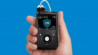 Artificial-Pancreas