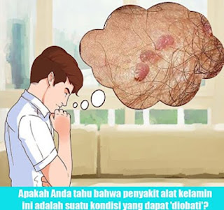 Obat penyakit kutil kelamin atau kutil di kemaluan atau kutil kelamin atau kutil di kemaluan, obat kutil kelamin atau kutil di kemaluan yang mujarab, apa obat kutil kelamin atau kutil di kemaluan yang ampuh, obat kutil di sekitar kelamin, obat kutil kelamin paling murah, jual obat penghilang kutil kelamin, obat tradisional untuk kutil kelamin atau kutil kelamin, obat kutil kelamin atau kutil di kemaluan secara tradisional, nama obat kutil kelamin untuk ibu hamil, tanaman obat kutil kelamin, penyebab kutil di kelamin