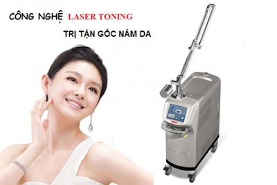 Bạn đã biết những gì về công nghệ trị nám bằng laser Toning?