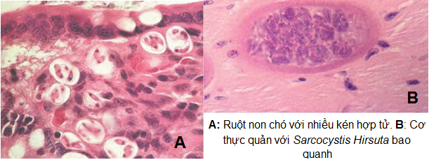 Hình 3: Bệnh tích mô học do sarcosystis