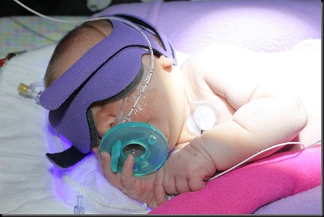 NICU