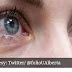 गुलाबी आंखें कोरोना वायरस महामारी का शुरुआती लक्षण भी हो सकती हैं।