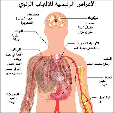 صورة