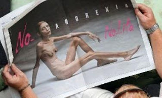 woman with anorexia