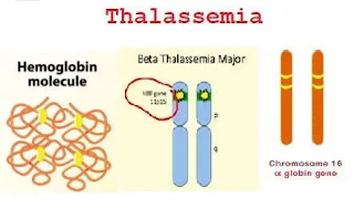 Thalassemia