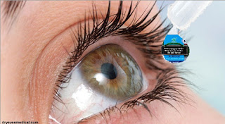 Eye Care Softgel Produk Green World