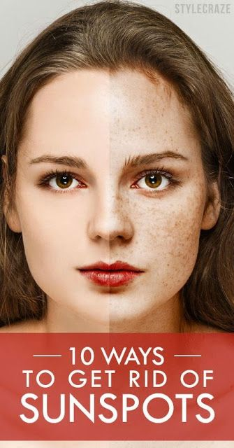 10 Ways to Get Rid of Sunspots