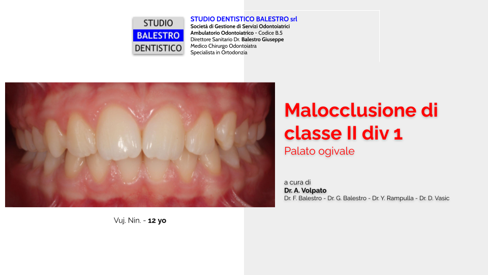 Studio Dentistico Balestro Malocclusione Di Ii Classe Div 1