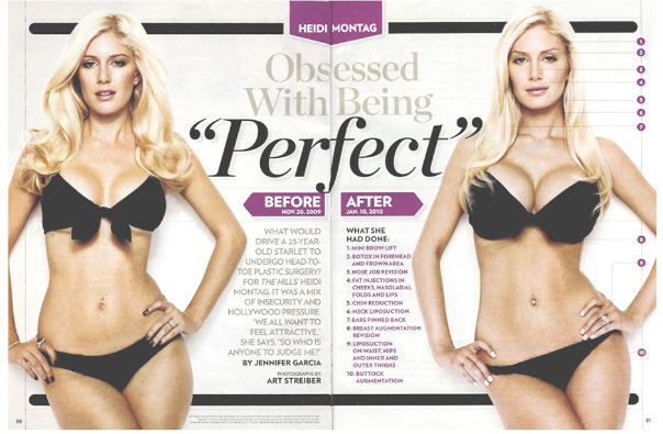 heidi montag after surgery photos. heidi montag before and after